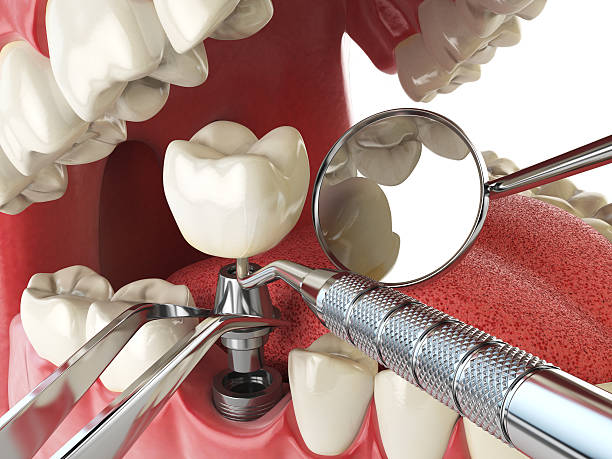 Best Emergency Treatment for Oral Infections in West Wendover, NV